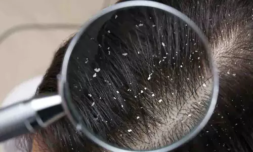 रूसी से जुड़े 5 मिथक जिन पर आपको तुरंत विश्वास करना बंद कर देना चाहिए