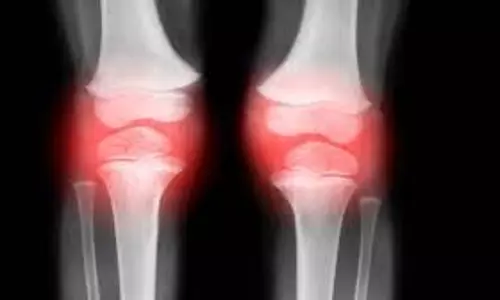 Health: कमजोर हड्डियों का क्या कारण है, एक्सपर्ट से जानें