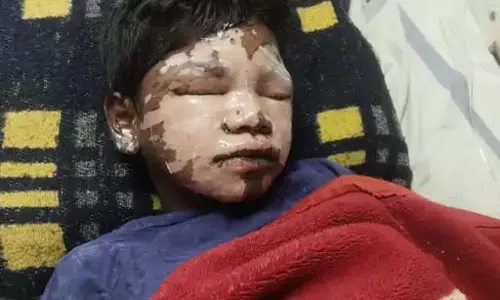 छात्रावास में छात्र मिलकर बना रहे थे खाना, हो गया बड़ा हादसा