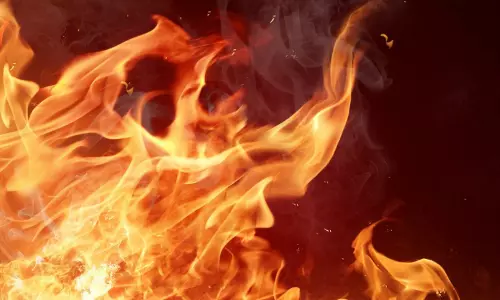 Lucknow: फैक्टरी में धमाके के बाद लगी आग से इलाके में अफरातफरी