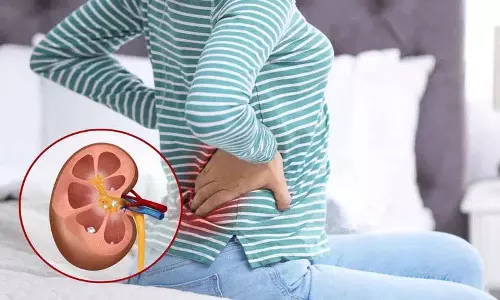 Kidney की पथरी के लक्षण: अगर हम अपने शरीर में इन संकेतों को देखें तो हम उन्हें जल्दी पहचान सकते हैं Kidney की पथरी के लक्षण: अगर हम अपने शरीर में इन संकेतों को देखें तो हम उन्हें जल्दी पहचान सकते हैं