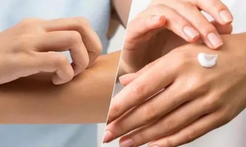 सर्दियों में रूखी और बेजान त्वचा? अपनाएँ ये 5 आसान उपाय सर्दियों में रूखी और बेजान त्वचा? अपनाएँ ये 5 आसान उपाय