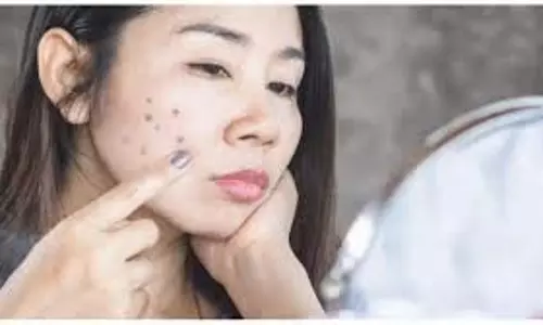 Skin Care: चेहरे के सारे दाग-धब्बे हो जाएंगे खत्म, बस चेहरे पर लगा लें ये चीज Skin Care: चेहरे के सारे दाग-धब्बे हो जाएंगे खत्म, बस चेहरे पर लगा लें ये चीज