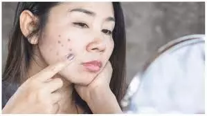 Skin Care: चेहरे के सारे दाग-धब्बे हो जाएंगे खत्म, बस चेहरे पर लगा लें ये चीज Skin Care: चेहरे के सारे दाग-धब्बे हो जाएंगे खत्म, बस चेहरे पर लगा लें ये चीज