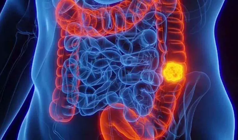 Colon Cleansing फूड्स: अद्भुत स्वास्थ्य लाभ के लिए इन्हें रोजाना लें Colon Cleansing फूड्स: अद्भुत स्वास्थ्य लाभ के लिए इन्हें रोजाना लें