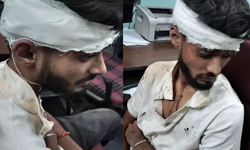 जोरा मैदान में छात्र को बेरहमी से पीटा, 5 युवकों पर FIR दर्ज जोरा मैदान में छात्र को बेरहमी से पीटा, 5 युवकों पर FIR दर्ज