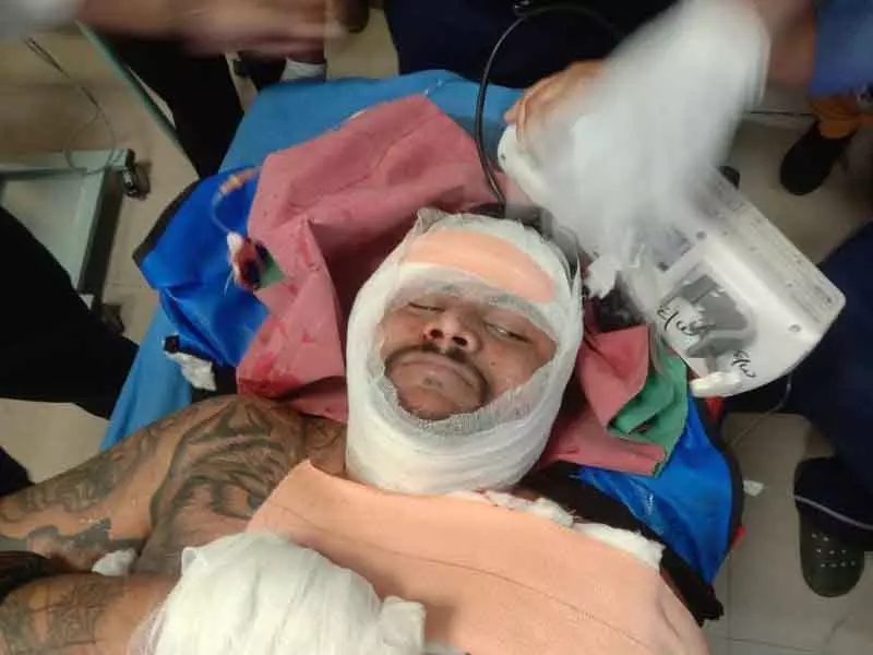 Phagwara बंगा में गोलीबारी में पांच घायल, पुलिस ने पुरानी रंजिश से जोड़ा हमला Phagwara बंगा में गोलीबारी में पांच घायल, पुलिस ने पुरानी रंजिश से जोड़ा हमला