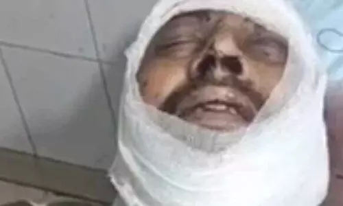 Ludhiana में डकैती की कोशिश नाकाम करने पर बदमाशों ने फैक्ट्री गार्ड पर हमला किया