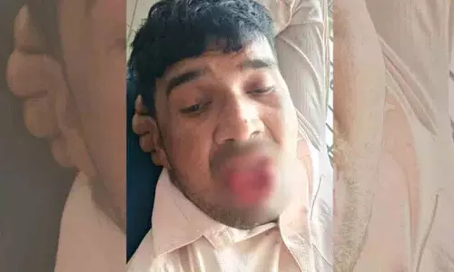 Kanpur में एक व्यक्ति ने अपनी पूर्व प्रेमिका को किस करने की कोशिश की, तो उसने उसकी जीभ काट ली Kanpur में एक व्यक्ति ने अपनी पूर्व प्रेमिका को किस करने की कोशिश की, तो उसने उसकी जीभ काट ली