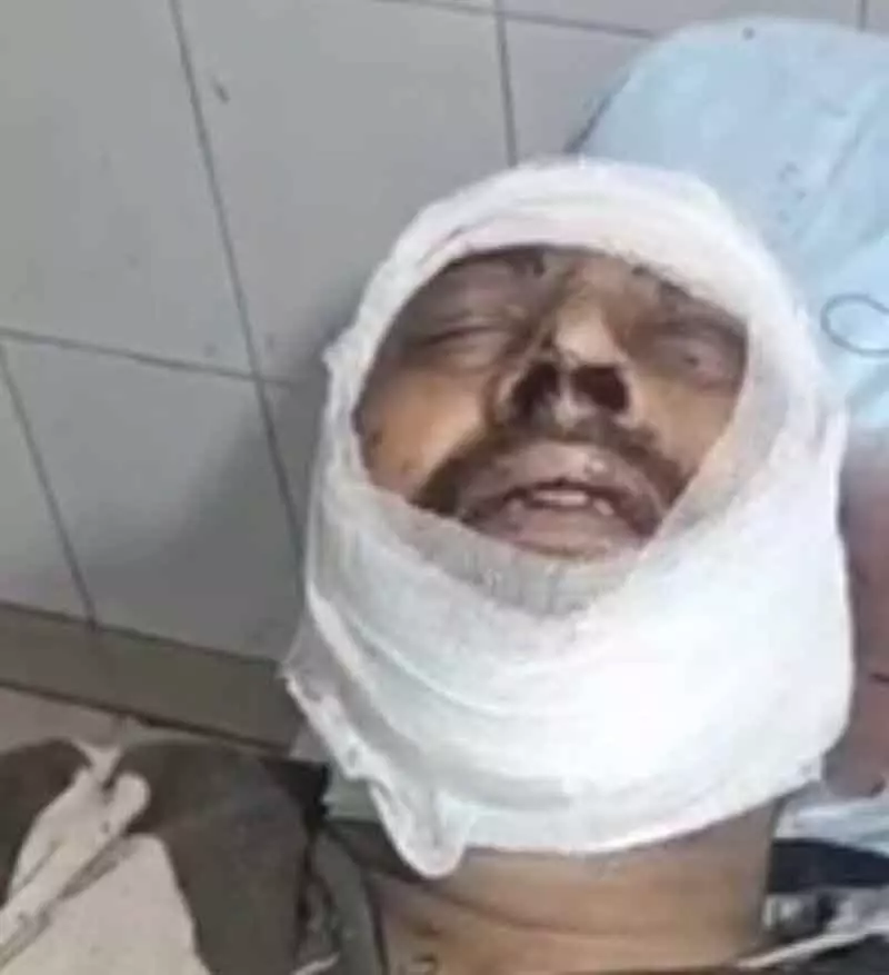 Ludhiana में डकैती की कोशिश नाकाम करने पर बदमाशों ने फैक्ट्री गार्ड पर हमला किया Ludhiana में डकैती की कोशिश नाकाम करने पर बदमाशों ने फैक्ट्री गार्ड पर हमला किया