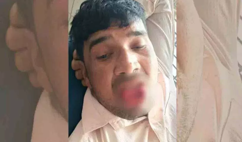 Kanpur में एक व्यक्ति ने अपनी पूर्व प्रेमिका को किस करने की कोशिश की, तो उसने उसकी जीभ काट ली Kanpur में एक व्यक्ति ने अपनी पूर्व प्रेमिका को किस करने की कोशिश की, तो उसने उसकी जीभ काट ली