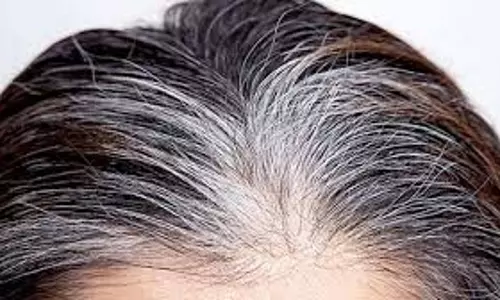 Hair Care: बालों को नेचुरली काला बनाने के लिए करें ये हल्दी वाला उपाय Hair Care: बालों को नेचुरली काला बनाने के लिए करें ये हल्दी वाला उपाय