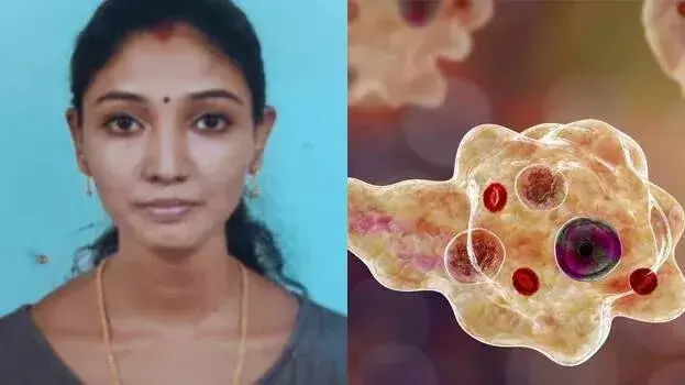 kerala: राजधानी में ब्रेन ईटिंग इन्फेक्शन से 26 साल की महिला की मौत kerala: राजधानी में ब्रेन ईटिंग इन्फेक्शन से 26 साल की महिला की मौत