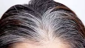 Hair Care: बालों को नेचुरली काला बनाने के लिए करें ये हल्दी वाला उपाय Hair Care: बालों को नेचुरली काला बनाने के लिए करें ये हल्दी वाला उपाय