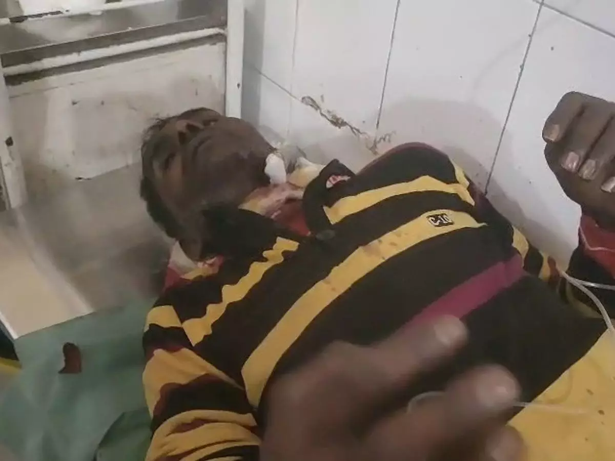 Sitapur: झगड़े में गर्दन पर किया हसिया हमला Sitapur: झगड़े में गर्दन पर किया हसिया हमला