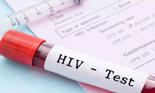 गोपनीय रखी जाएगी HIV रिपोर्ट को, आदेश जारी गोपनीय रखी जाएगी HIV रिपोर्ट को, आदेश जारी