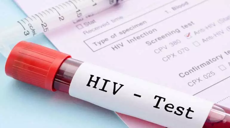 गोपनीय रखी जाएगी HIV रिपोर्ट को, आदेश जारी गोपनीय रखी जाएगी HIV रिपोर्ट को, आदेश जारी