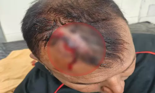रायपुर में पत्रकार दंपत्ति से मारपीट, FIR दर्ज
