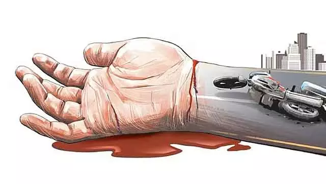 नेलमंगला में बाइक एक्सीडेंट: जर्मनी से शादी में आए MS स्टूडेंट की मौत नेलमंगला में बाइक एक्सीडेंट: जर्मनी से शादी में आए MS स्टूडेंट की मौत