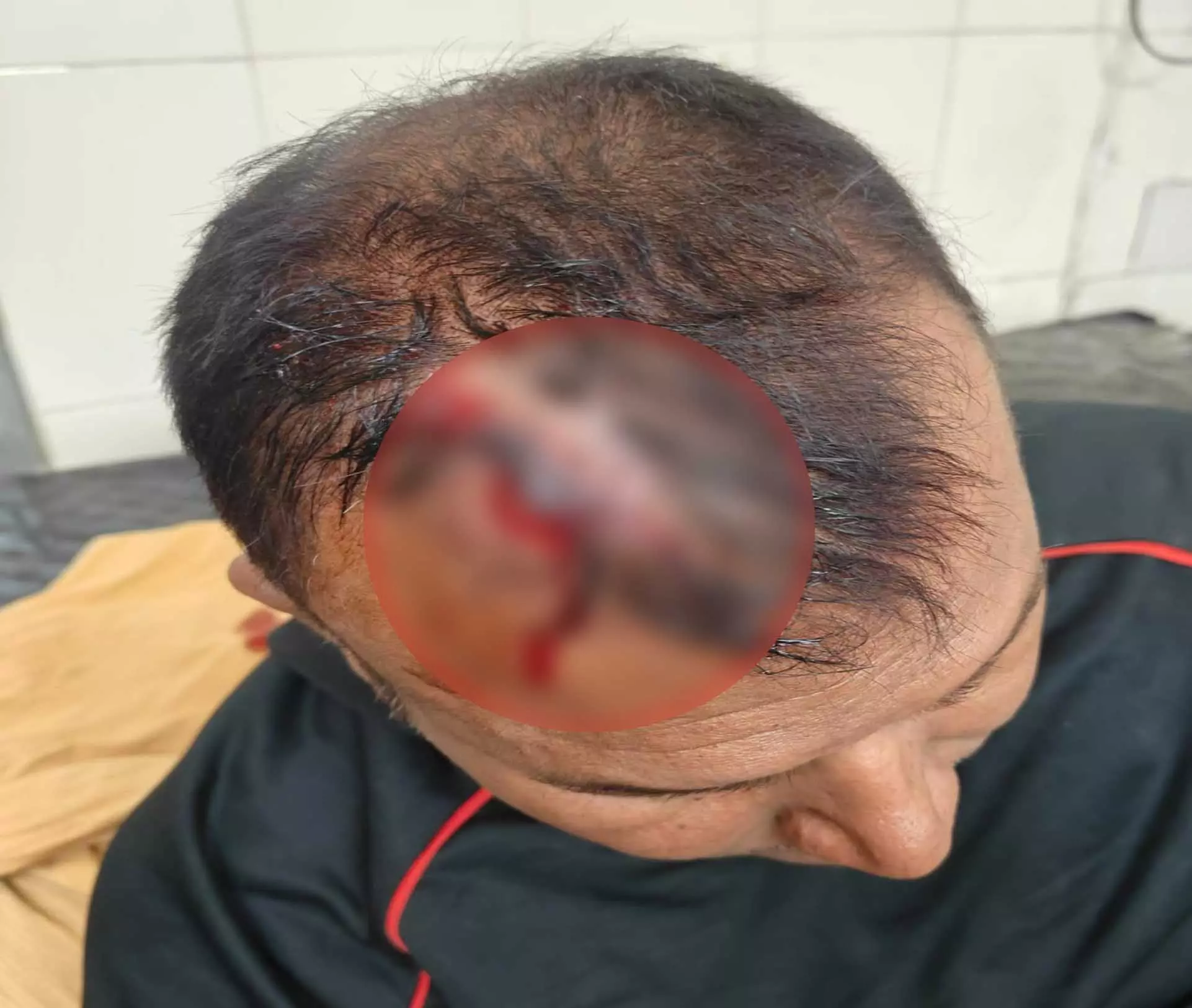 रायपुर में पत्रकार दंपत्ति से मारपीट, FIR दर्ज रायपुर में पत्रकार दंपत्ति से मारपीट, FIR दर्ज