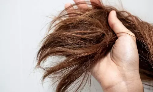 Hair Care: स्प्लिट एंड्स का इलाज करने के 8 तरीके Hair Care: स्प्लिट एंड्स का इलाज करने के 8 तरीके