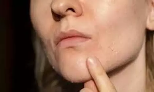 Skin Care: सर्दियों में स्किन ड्राई रहती है तो इस हाइड्रेशन रूटीन को फॉलो करें Skin Care: सर्दियों में स्किन ड्राई रहती है तो इस हाइड्रेशन रूटीन को फॉलो करें