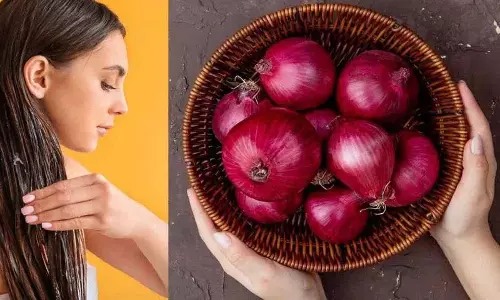 प्याज के रस के साथ ये घरेलू टिप्स अपनाएं.. जन्म के समय आपके बाल नहीं झड़ेंगे..! प्याज के रस के साथ ये घरेलू टिप्स अपनाएं.. जन्म के समय आपके बाल नहीं झड़ेंगे..!