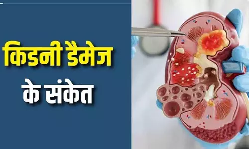 Kidney Damage के 4 आंखों में दिखने वाले लक्षण, समय पर पहचान जरूरी Kidney Damage के 4 आंखों में दिखने वाले लक्षण, समय पर पहचान जरूरी
