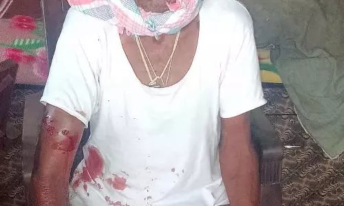 Magadi : पालतू कुत्तों के हमले में व्यक्ति घायल Magadi : पालतू कुत्तों के हमले में व्यक्ति घायल