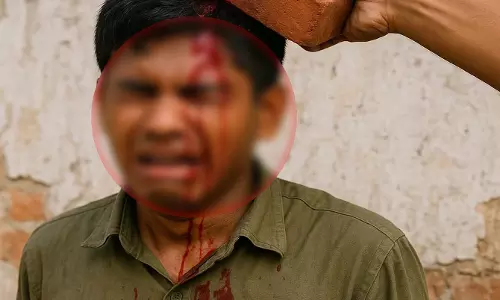 पड़ोसी से गाड़ी हटाने की बात कहने पर युवक पर हमला, ईंट से सिर फोड़ा पड़ोसी से गाड़ी हटाने की बात कहने पर युवक पर हमला, ईंट से सिर फोड़ा