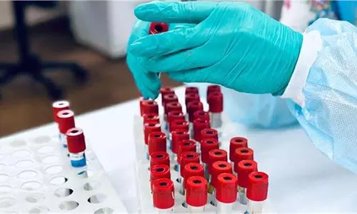 Blood Group: इस Blood Group वालों में लिवर डैमेज का खतरा अधिक Blood Group: इस Blood Group वालों में लिवर डैमेज का खतरा अधिक