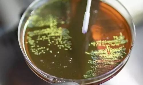 स्टडी में खुलासा: मुंबई की खाड़ी के अमीबा में बढ़ा AMR बैक्टीरिया खतरा स्टडी में खुलासा: मुंबई की खाड़ी के अमीबा में बढ़ा AMR बैक्टीरिया खतरा