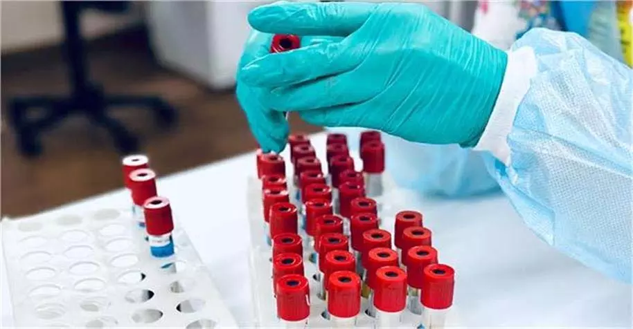 Blood Group: इस Blood Group वालों में लिवर डैमेज का खतरा अधिक Blood Group: इस Blood Group वालों में लिवर डैमेज का खतरा अधिक