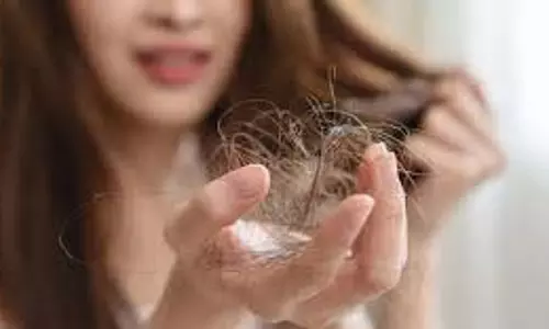 Hair Care: बालों का झड़ना रोकने के लिए असरदार उपाय Hair Care: बालों का झड़ना रोकने के लिए असरदार उपाय