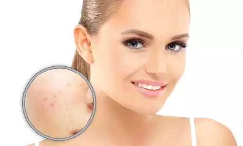Skin Care:  स्किन पिगमेंटेशन का इलाज करने के 10 DIY तरीके
