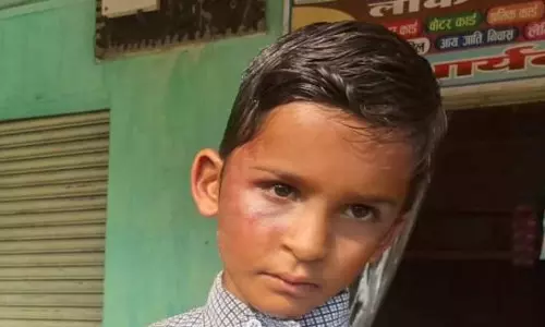 पहाड़ा नहीं पढ़ सका छात्र, शिक्षक की पिटाई से चेहरे में सूजन पहाड़ा नहीं पढ़ सका छात्र, शिक्षक की पिटाई से चेहरे में सूजन
