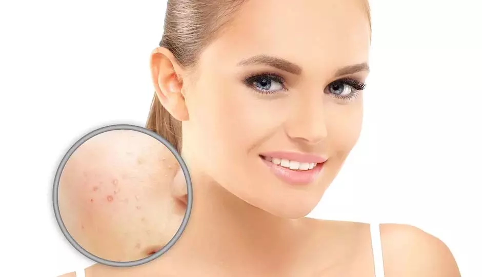 Skin Care: स्किन पिगमेंटेशन का इलाज करने के 10 DIY तरीके Skin Care: स्किन पिगमेंटेशन का इलाज करने के 10 DIY तरीके