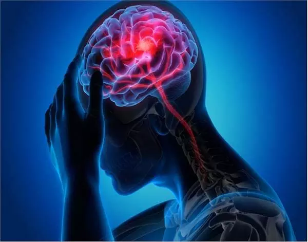 Health: ब्रेन ट्यूमर के लक्षण क्या है, यह कैसे ठीक होता है जानें बचाव के तरीके Health: ब्रेन ट्यूमर के लक्षण क्या है, यह कैसे ठीक होता है जानें बचाव के तरीके