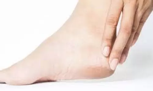 Skin Care: सर्दियों में फट गई हैं एडियां, घर पर ही बस 2 चीजों से बनाएं क्रेक क्रीम Skin Care: सर्दियों में फट गई हैं एडियां, घर पर ही बस 2 चीजों से बनाएं क्रेक क्रीम