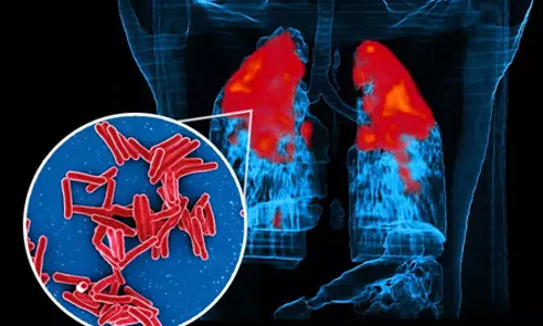 TB bacteria: अध्ययन से पता चला कैसे टीबी बैक्टीरिया एंटीबायोटिक दवाओं को देते हैं धोखा TB bacteria: अध्ययन से पता चला कैसे टीबी बैक्टीरिया एंटीबायोटिक दवाओं को देते हैं धोखा