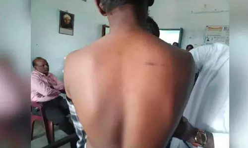 Telangana में वाइस-कैप्टन चुने जाने पर सीनियर्स ने स्टूडेंट को पीटा Telangana में वाइस-कैप्टन चुने जाने पर सीनियर्स ने स्टूडेंट को पीटा