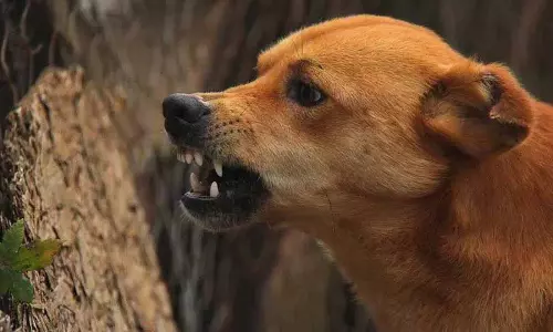 Narsapur में आवारा कुत्ते के हमले में छह साल का बच्चा घायल Narsapur में आवारा कुत्ते के हमले में छह साल का बच्चा घायल