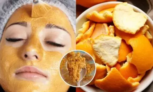 संतरे के छिलके से मुंहासे, फुंसी और निशान कम करने का आसान घरेलू उपाय
