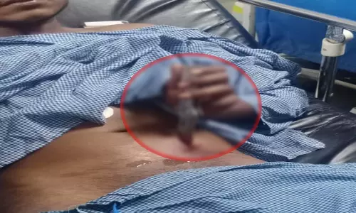 Raipur Breaking: आजाद चौक में युवक से चाकूबाजी, पेट में फसा चाकू