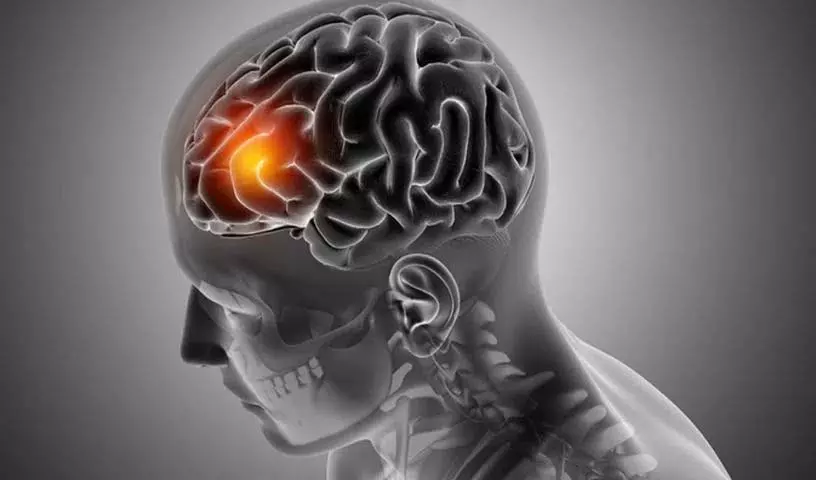 देश में Neurological बीमारियां बढ़ रही हैं.. हर तीन में से एक परिवार में देश में Neurological बीमारियां बढ़ रही हैं.. हर तीन में से एक परिवार में