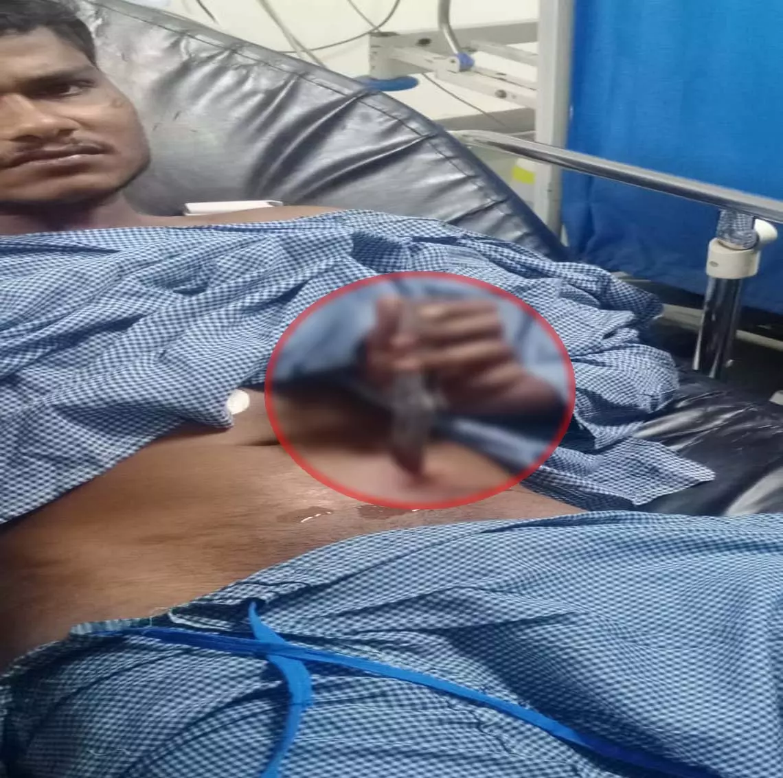 Raipur Breaking: आजाद चौक में युवक से चाकूबाजी, पेट में फसा चाकू Raipur Breaking: आजाद चौक में युवक से चाकूबाजी, पेट में फसा चाकू