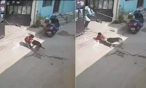 Hyderabad के यूसुफगुडा में दो साल के बच्चे पर आवारा कुत्तों का हमला