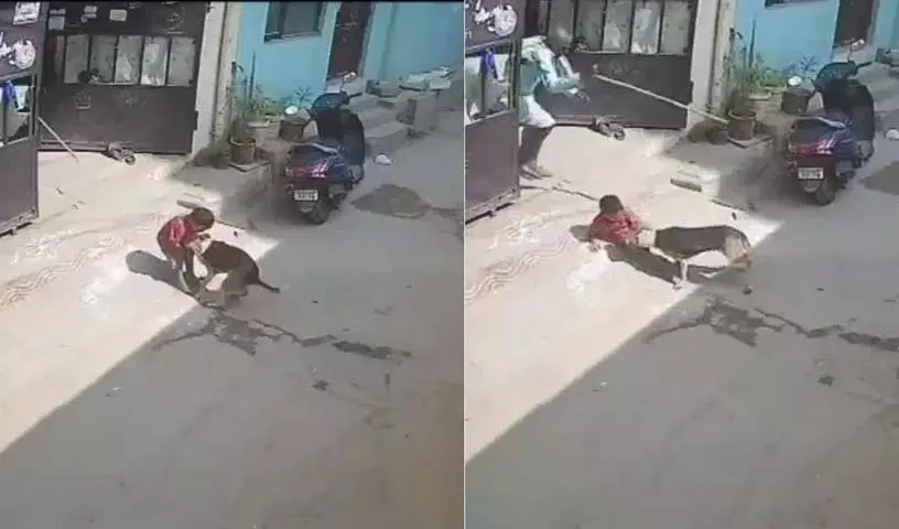 Hyderabad के यूसुफगुडा में दो साल के बच्चे पर आवारा कुत्तों का हमला Hyderabad के यूसुफगुडा में दो साल के बच्चे पर आवारा कुत्तों का हमला