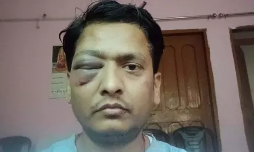 पत्नी-साले ने युवक को पीटा, पुलिस का ढीला रवैया सवालों के घेरे में पत्नी-साले ने युवक को पीटा, पुलिस का ढीला रवैया सवालों के घेरे में