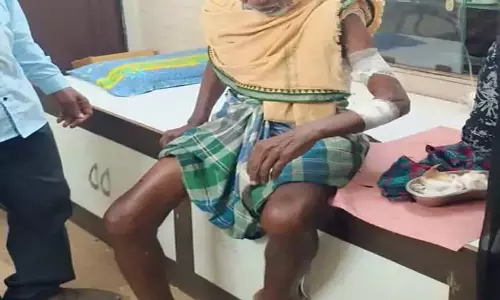 Boar attack: जंगली सुअर के हमले में ग्रामीण घायल, वन विभाग सतर्क Boar attack: जंगली सुअर के हमले में ग्रामीण घायल, वन विभाग सतर्क